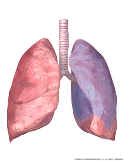 Lungs and Trachea with Superior Left Lobe Highlighted Image
