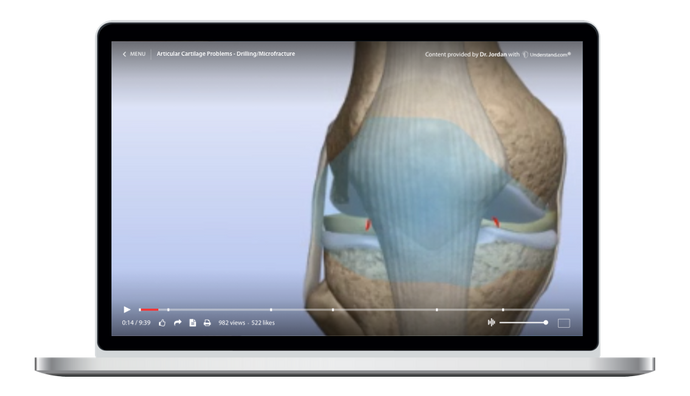 Articular Cartilage Problems - Drilling/Microfracture Animation