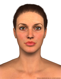 Face Female Anterior Image