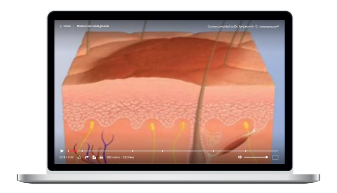 Molluscum Contagiosum Animation