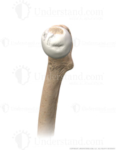 Hip Damaged Cartilage Medial Image
