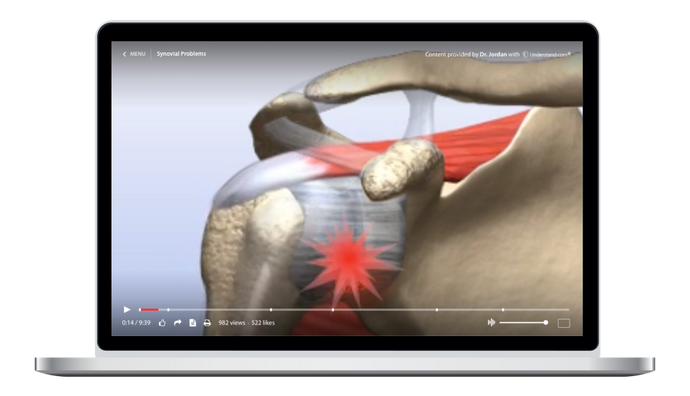 Synovial Problems Animation