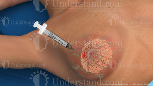 Breast Biopsy Image