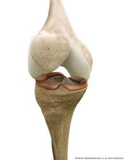 Torn Meniscus Anterior Flexed Image