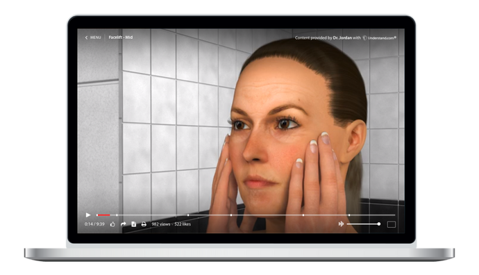 Facelift - Mid Animation