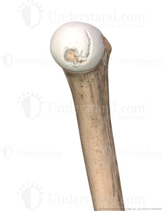 Shoulder Damaged Cartilage Medial Image
