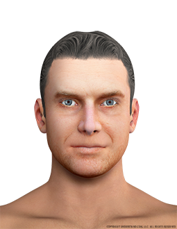 Face Male Anterior Image