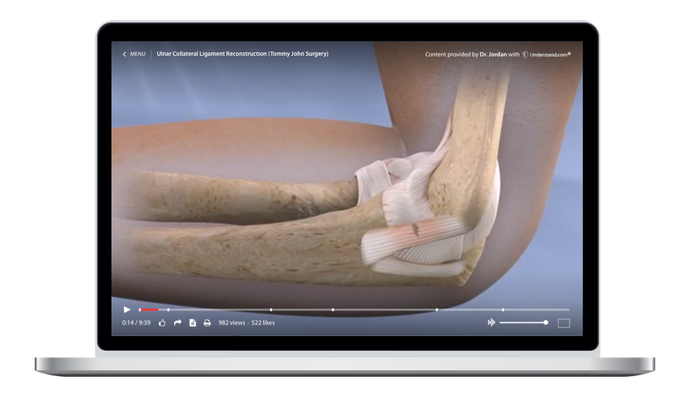 Ulnar Collateral Ligament Reconstruction (Tommy John Surgery) Animation