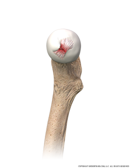 Ligamentum Teres Medial Image
