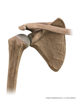 Shoulder Bone, Anterior Three Quarter Image