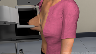 Woman Receiving Mammogram View 1 Image