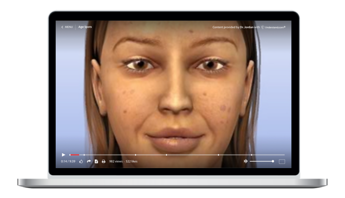 Age Spots Animation