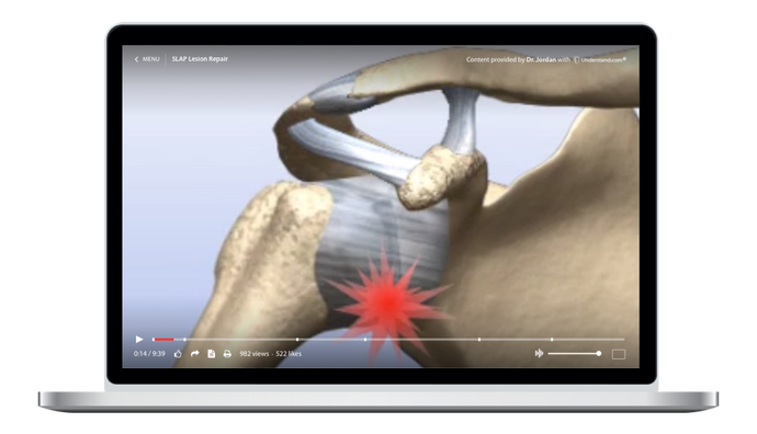 SLAP Lesion Repair Animation