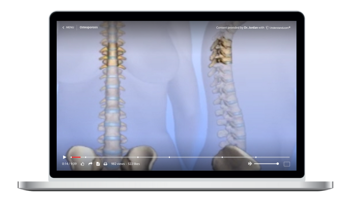 Osteoporosis Animation