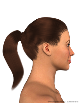 Face Female Right Lateral Image