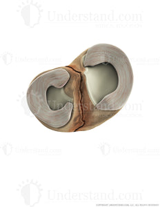 Tibial Fracture Superior Image