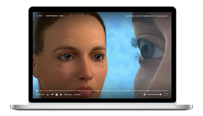 Eyelid Surgery - Lower Animation