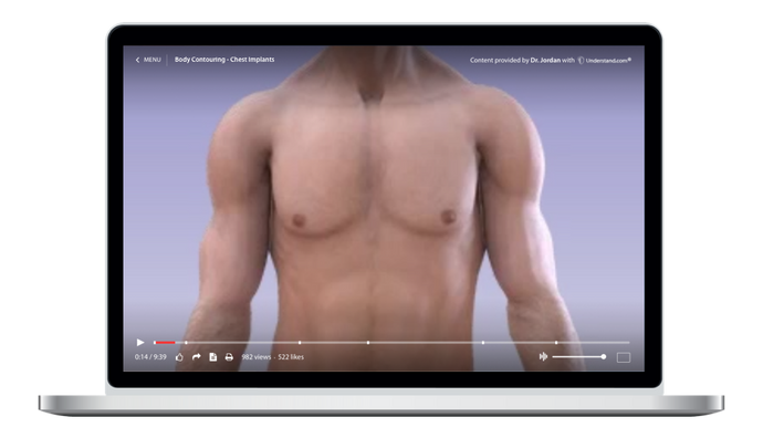 Body Contouring Implants - Chest (Pectoral) Animation