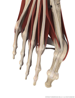 Bunionectomy Image
