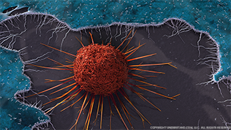 Cancer Cell Image