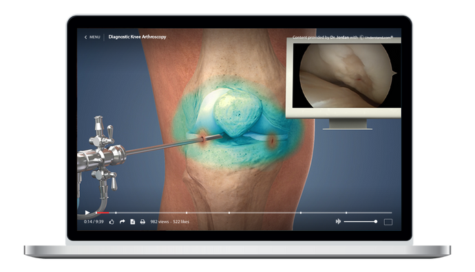 Diagnostic Knee Arthroscopy Animation