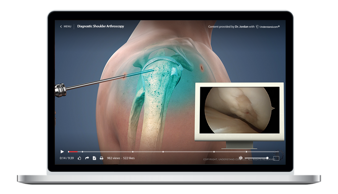 Diagnostic Shoulder Arthroscopy Animation