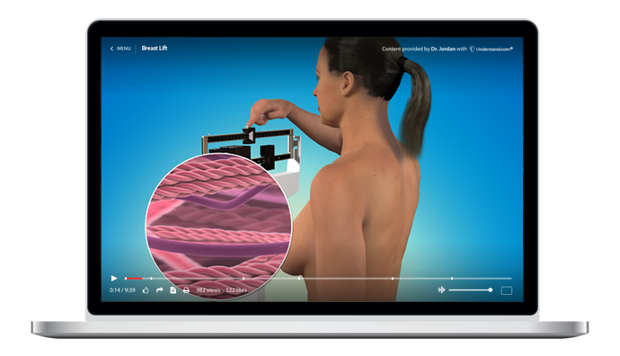 Breast Lift Animation