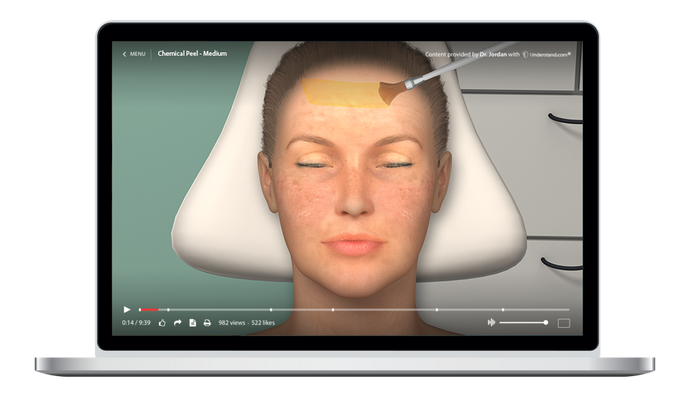 Chemical Peel - Medium Animation