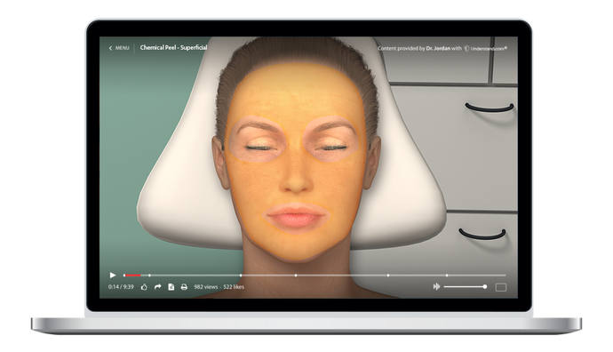 Chemical Peel - Superficial Animation on Laptop
