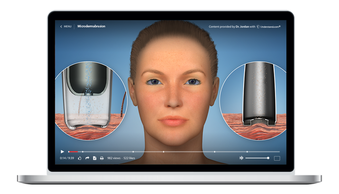 Microdermabrasion Animation