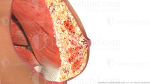 Breast Calcifications Image