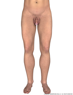 Lower Body Male Anterior Image