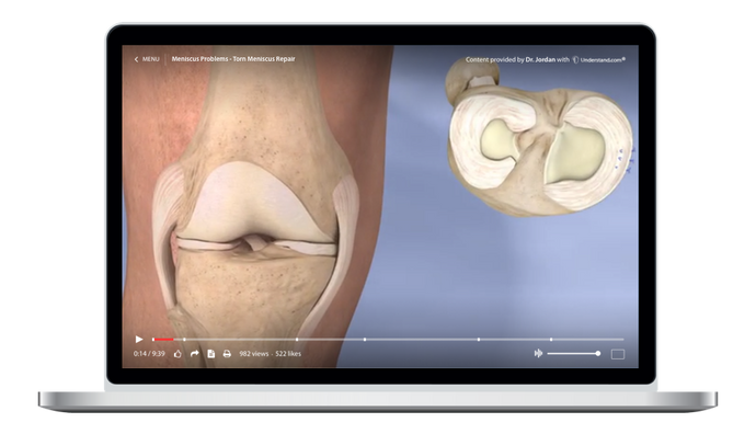 Meniscus Problems - Torn Meniscus Repair Animation