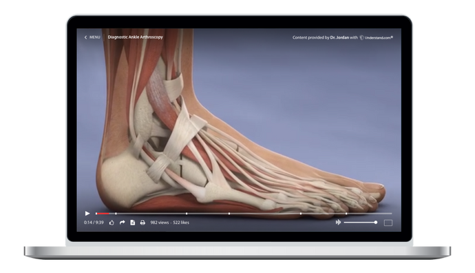Diagnostic Ankle Arthroscopy Animation