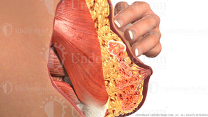 Breast Self Exam Medium Pressure Image