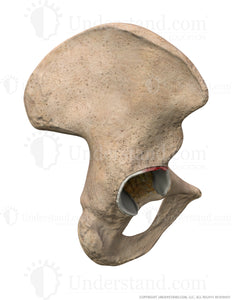 Hip Detached Labrum Lateral Image