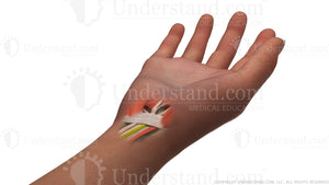 Carpal Tunnel Release Image