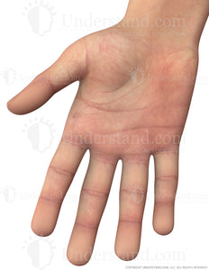 Hand Male Right Palmar Image