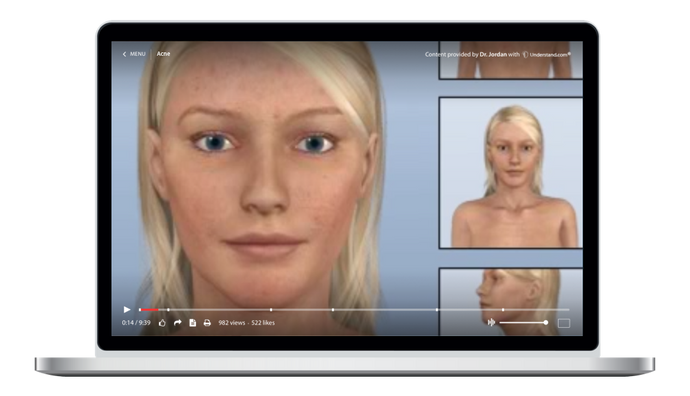 Acne Animation