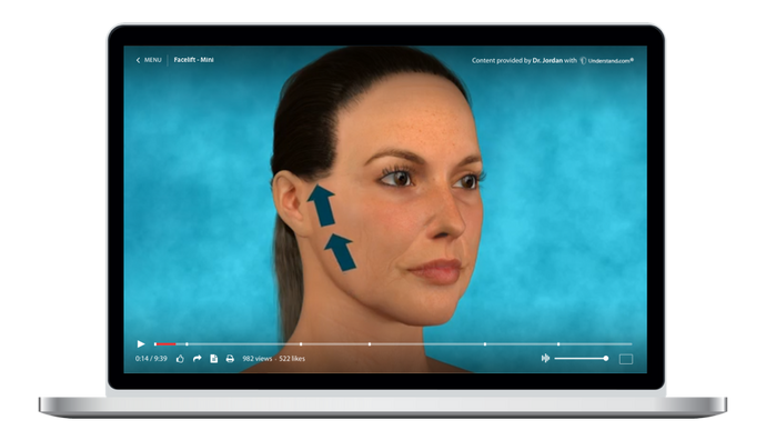 Facelift - Mini Animation
