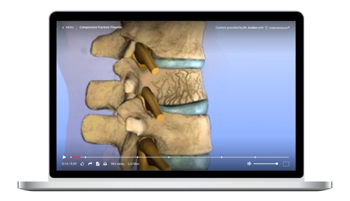 Compression Fracture (Trauma) Animation