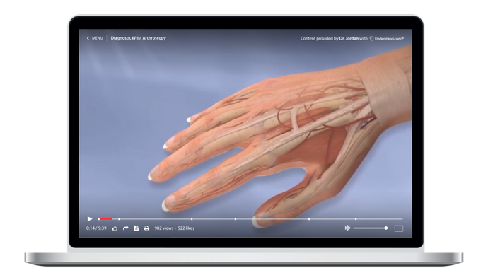 Wrist Arthroscopy Animation