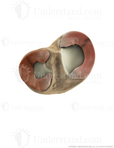 Torn Meniscus Superior Image