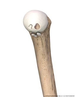 Shoulder Loose Bodies Medial Image