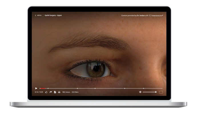 Eyelid Surgery - Upper Animation