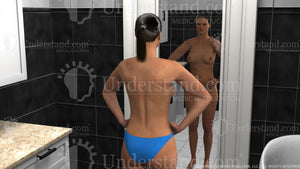 Breast Self Exam Visual Inspection Shoulders Forward Image