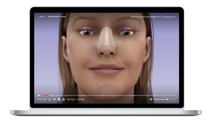 Facial Implants - Nasal Animation